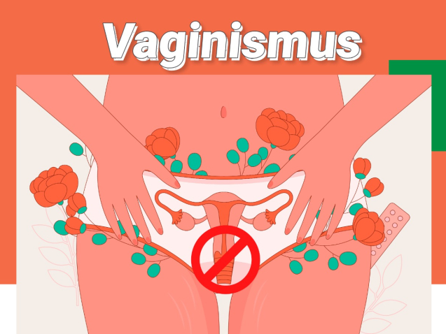 Vaginismus